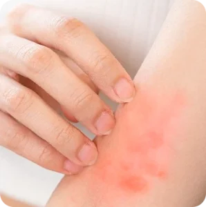 Soothes-irritation-Heal-by-CiCA-Glocalcare-copy-298x300