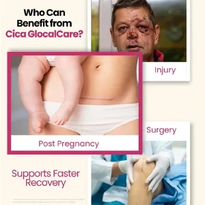 imgi_111_GlocalCica