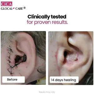 imgi_113_Cica-4